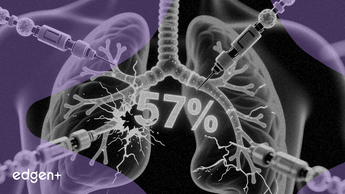 Nanobiotix Posts 57% Complete Response in Phase 2 Lung Cancer Study